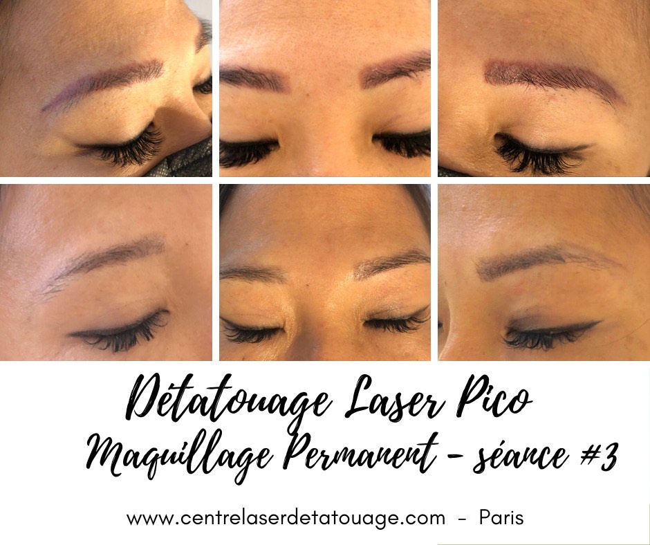 Détatouage microshading maquillage permanent sourcils à Paris