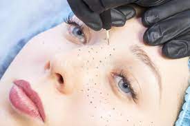 Effacer la dermopigmentation